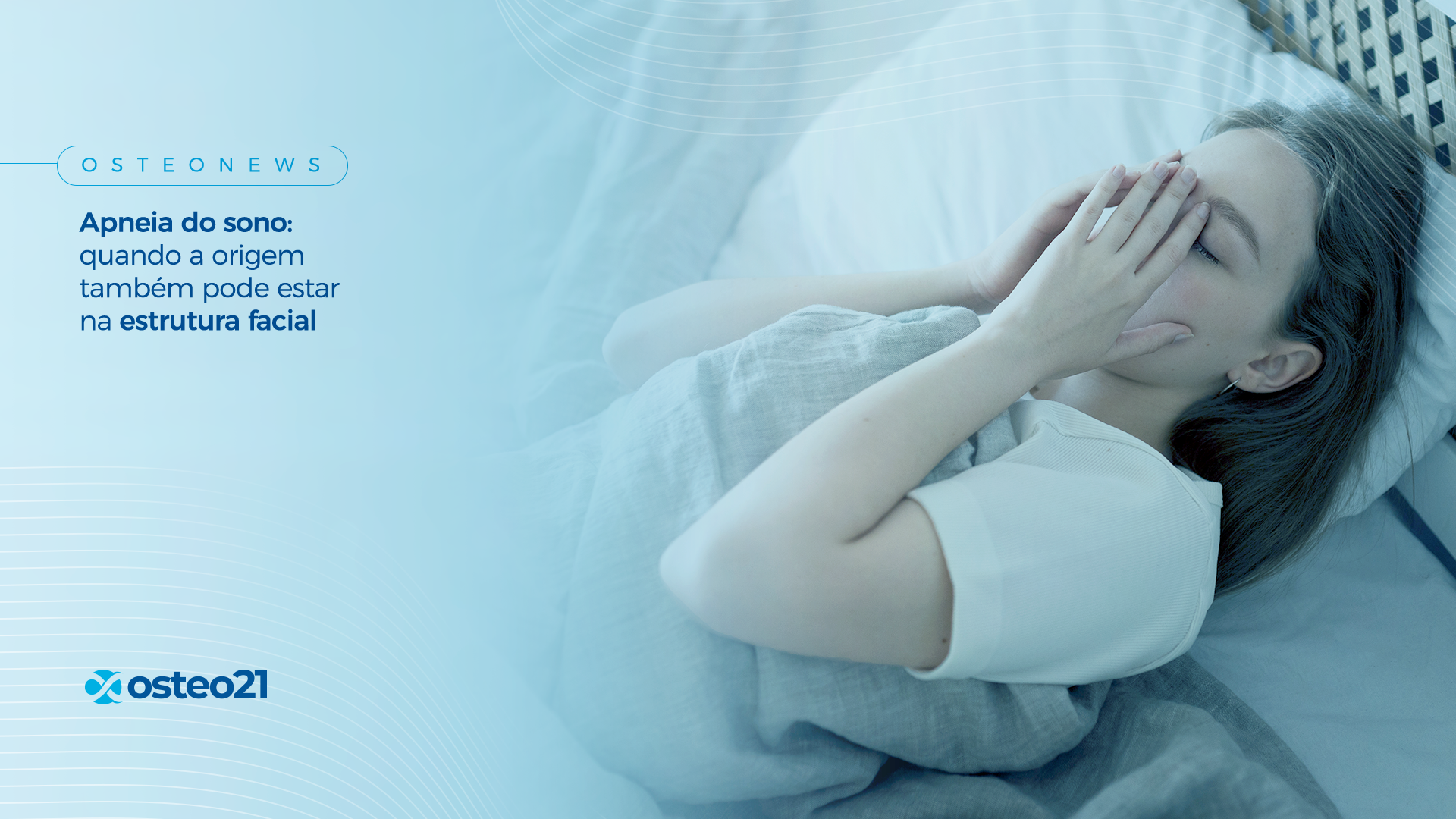 Apneia do sono: quando a origem também pode estar na estrutura facial