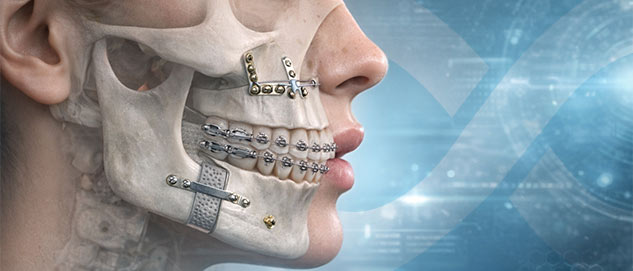 Bucomaxilofacial